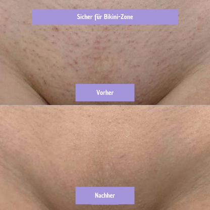 Glaire Haar-Entferner